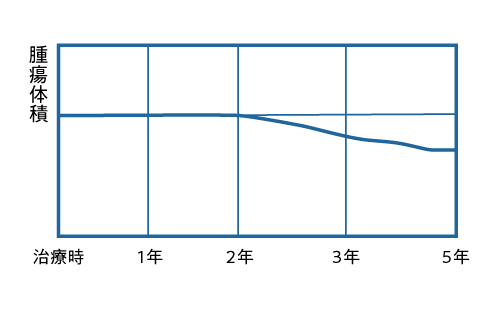 ガンマナイフ後の経過観察