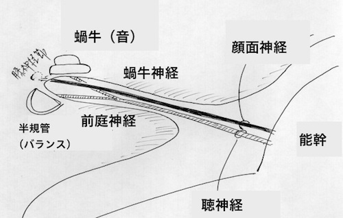 ガンマナイフ治療