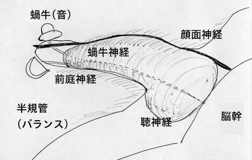 ガンマナイフ治療