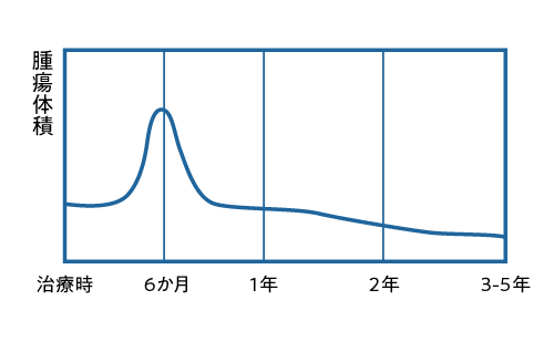 治療後腫瘍大きさの継時的変化