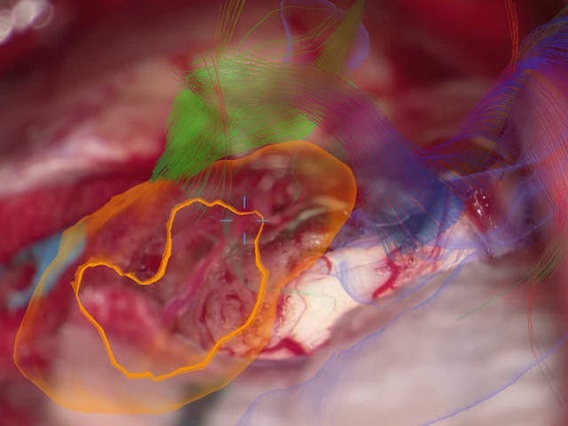 脳神経外科手術用顕微鏡 KINEVO 900(ZEISS社製) 